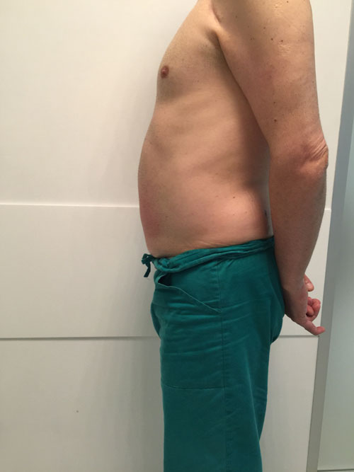 Deep Beauty Lipo Act