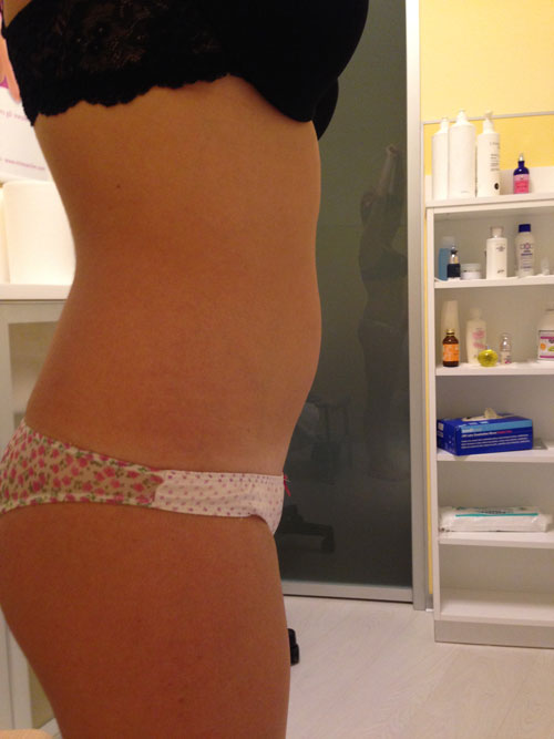 Deep Beauty Lipo Act