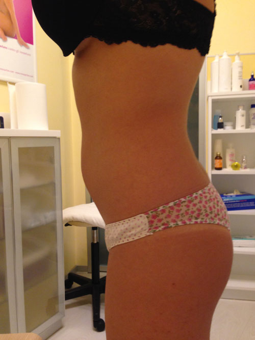 Deep Beauty Lipo Act
