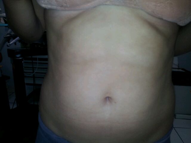 Deep Beauty Lipo Act